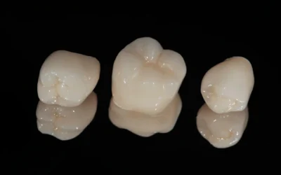 Discover the Beauty and Benefits of White Zirconia Crowns for Kids in Baltimore